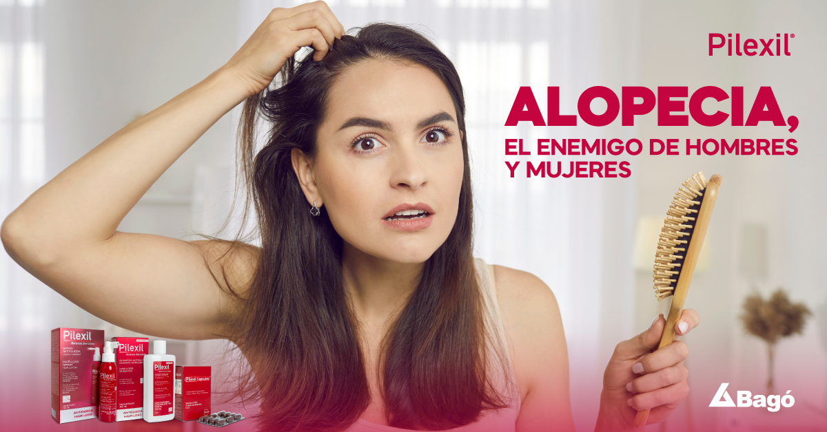 Alopecia, afecta a hombres y mujeres