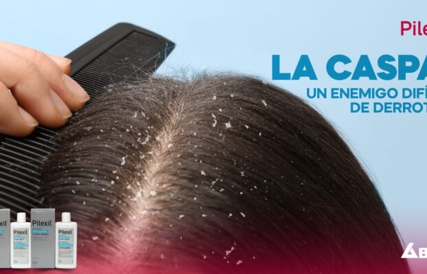 La caspa, ¿la podemos controlar?
