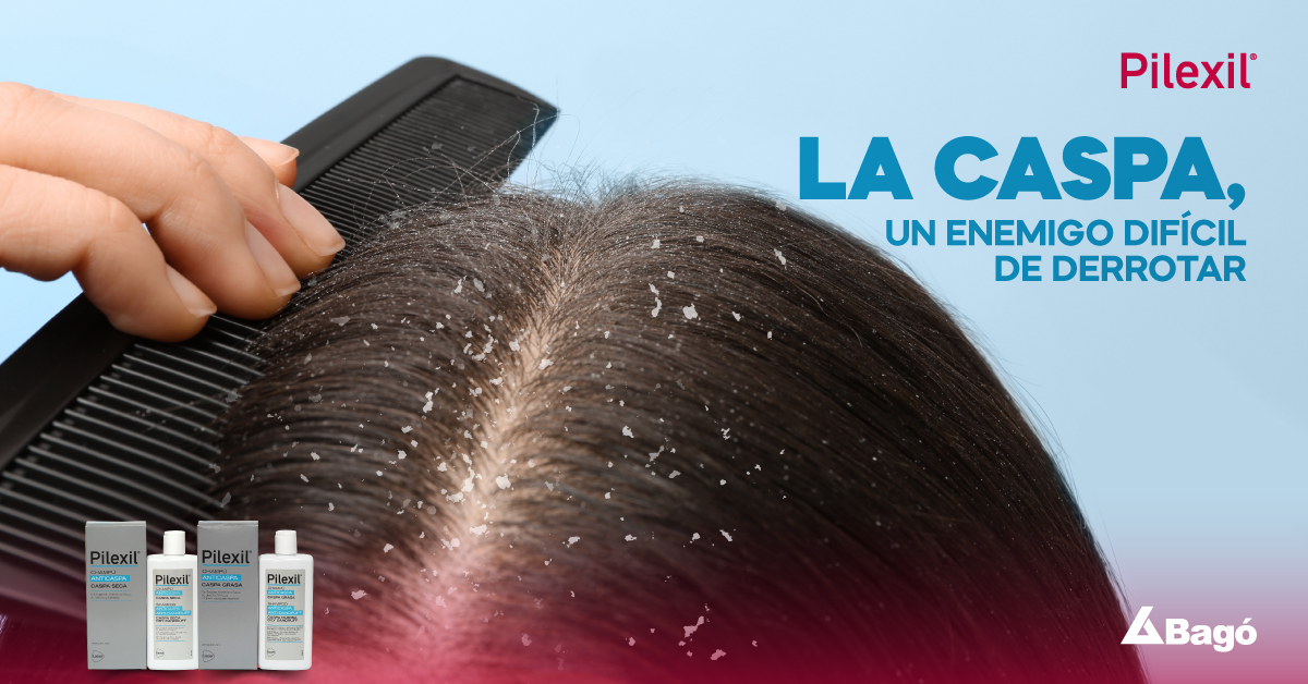 La caspa, ¿la podemos controlar?