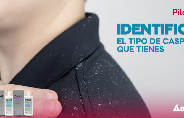 Identifica el tipo de caspa que tienes